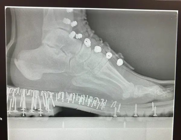 grayscale x-ray of a foot in a Nicks boot showing clinching nails through the heel seat and shank